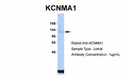 Maxi Potassium channel alpha Antibody, Novus Biologicals 100 &mu;L; Unconjugated:Antibodies,